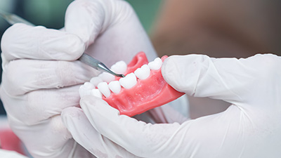 Lab worker crafting new dentures