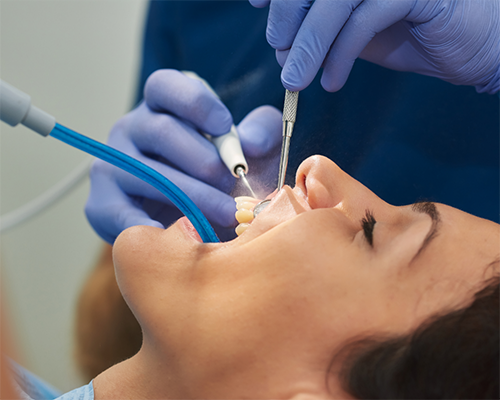 Woman getting a dental cleaning
