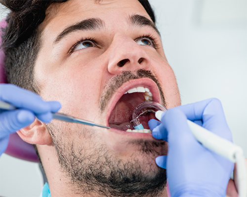 Man getting a dental cleaning