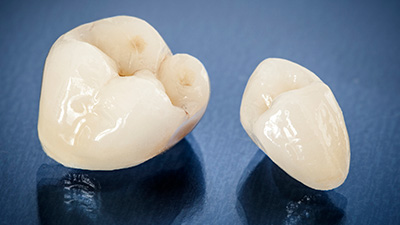 dental crown prior to placement