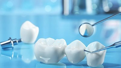 a dental bridge on a blue table 