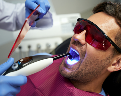 Young man getting cosmetic dental bonding