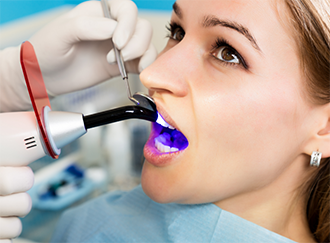 Woman getting dental bonding on her front tooth