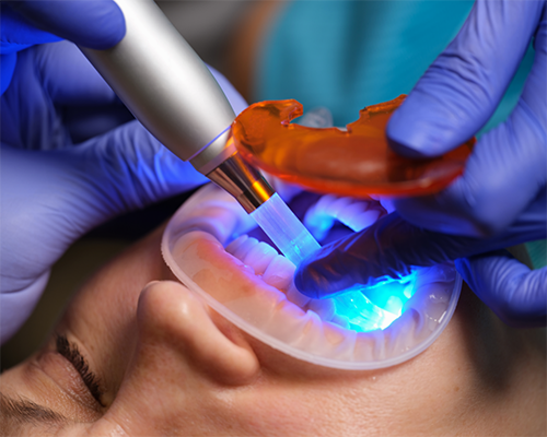 Close-up of a dental patient getting cosmetic bonding