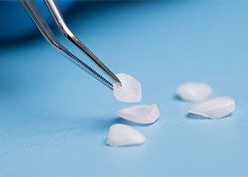 veneers on table in Irving