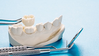 a close-up of a dental crown on a model tooth