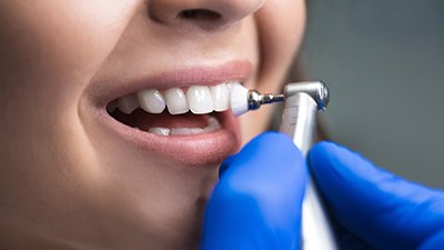 a patient’s smile after receiving a dental crown