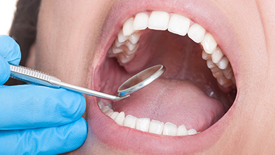 Patient receiving dental exam