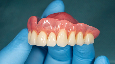 Dentist with glove holding a set of full dentures