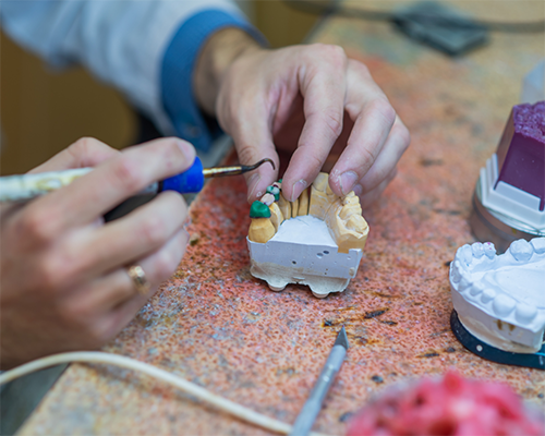 Dental lab worker adjusting a denture