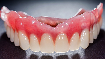 Set of full dentures