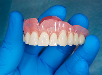 Gloved hand holding a full denture