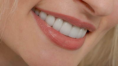 Closeup of healthy smile