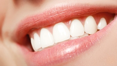 Beautiful smile after cosmetic gum surgery in Irving