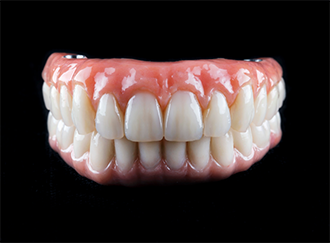 Set of implant dentures against black background