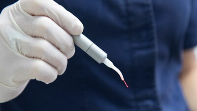 a dentist holding a dental laser