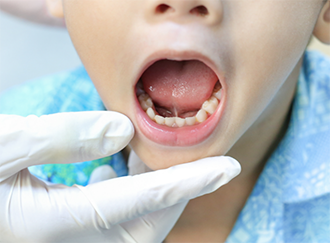 Young boy opening his mouth wide