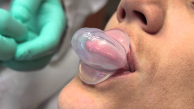 Tongue retaining device