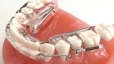 Model smile with Inman aligners