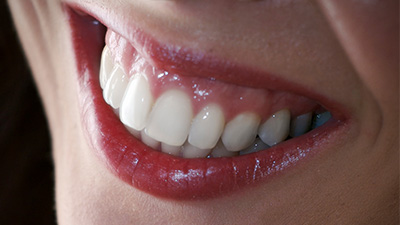 closeup of healthy teeth and gums