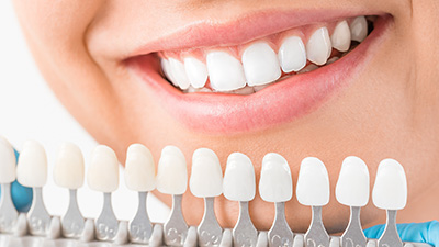 Closeup of teeth compared with tooth color chart