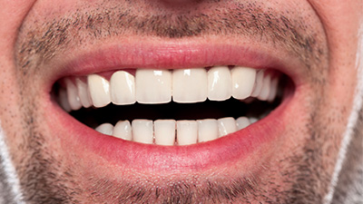 Closeup of healthy smile