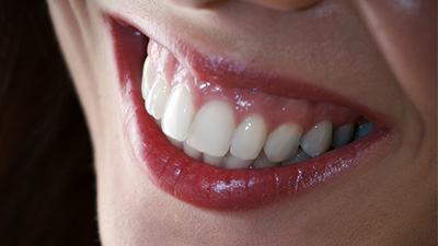 Closeup of health teeth and gums