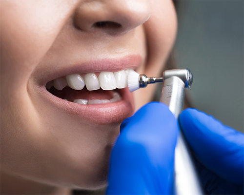 Woman having fluoride applied to her teeth