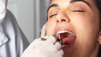 Woman with eyes closed receiving dental care