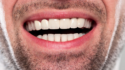 Closeup of healthy smile