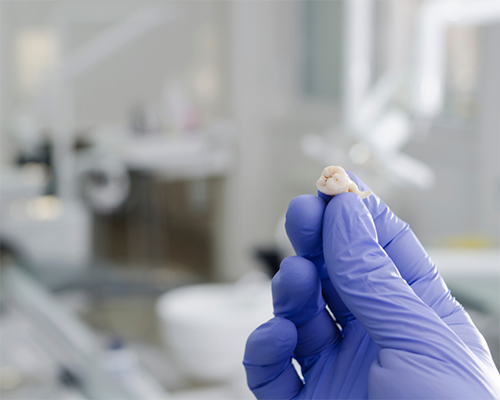 Dentist holding an extracted tooth