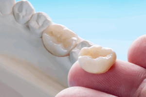 a close-up of a dental crown