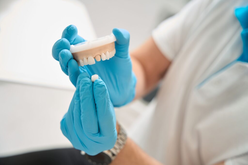 Dentist placing sample crown over model jaw and tooth