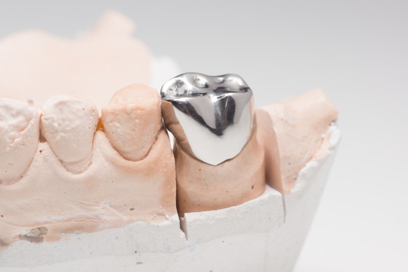 A closeup of a metal dental crown