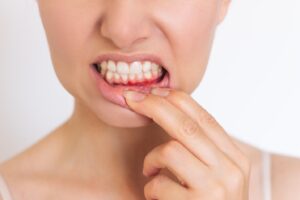 woman showing her red gum tissue